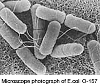 Microscope photograph of E.coli O-157